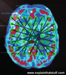 General illustration of a neural network: a brain scan photo overlaid with dots to represent connected neural units.