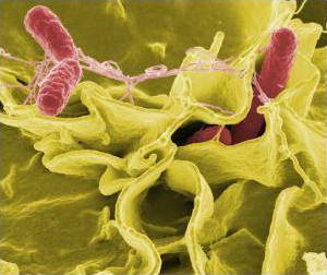 Salmonella under an electron microscope